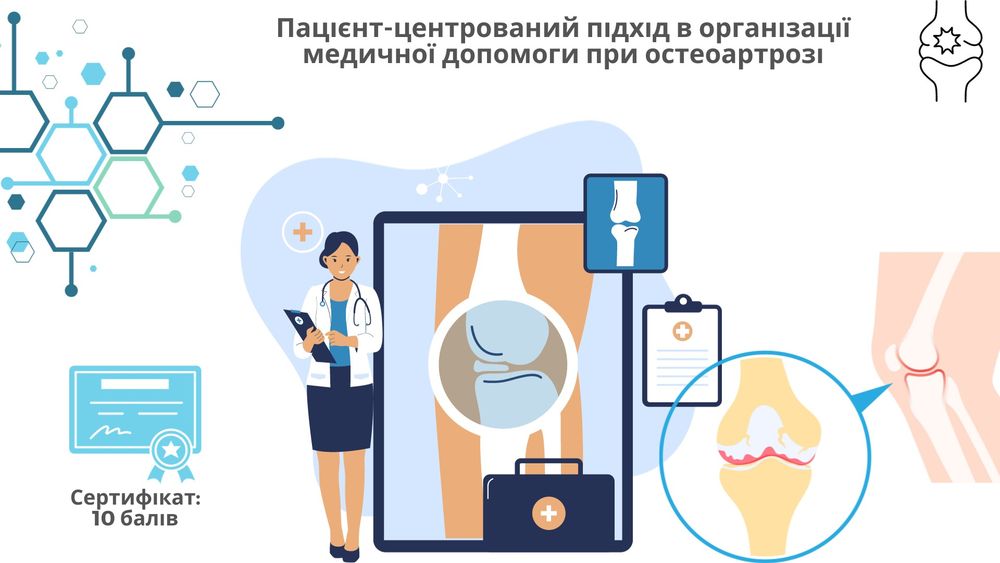 Секрети лікування остеоартрозу і ожиріння від ревматолога і ендокринолога. Пацієнт-центрований підхід в організації медичної допомоги при остеоартрозі.